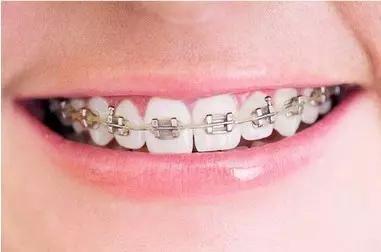 常州瀚景口腔牙齒拋光怎么樣？牙齒拋光有什么作用？