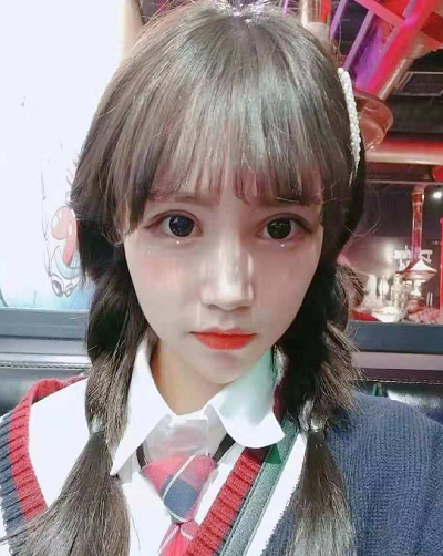 成都美立方（原華博）醫(yī)療美容醫(yī)院做眼部修復手術后的三個月